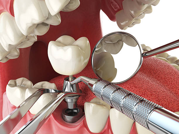Best Weekend Emergency Dentist in Una, WA